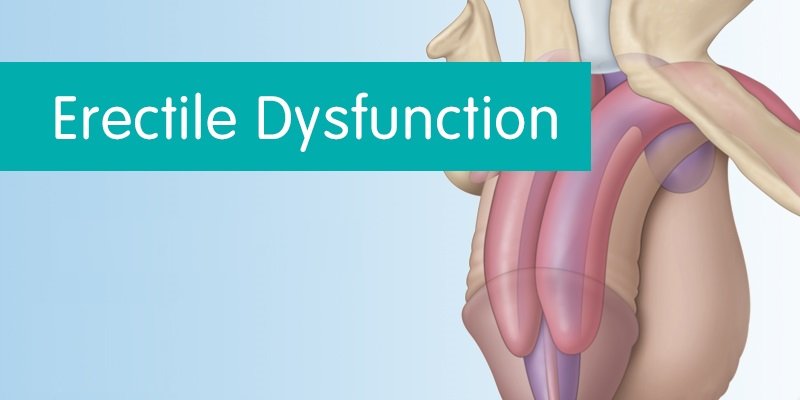 Erectile-Dysfunction Erectile-Dysfunction