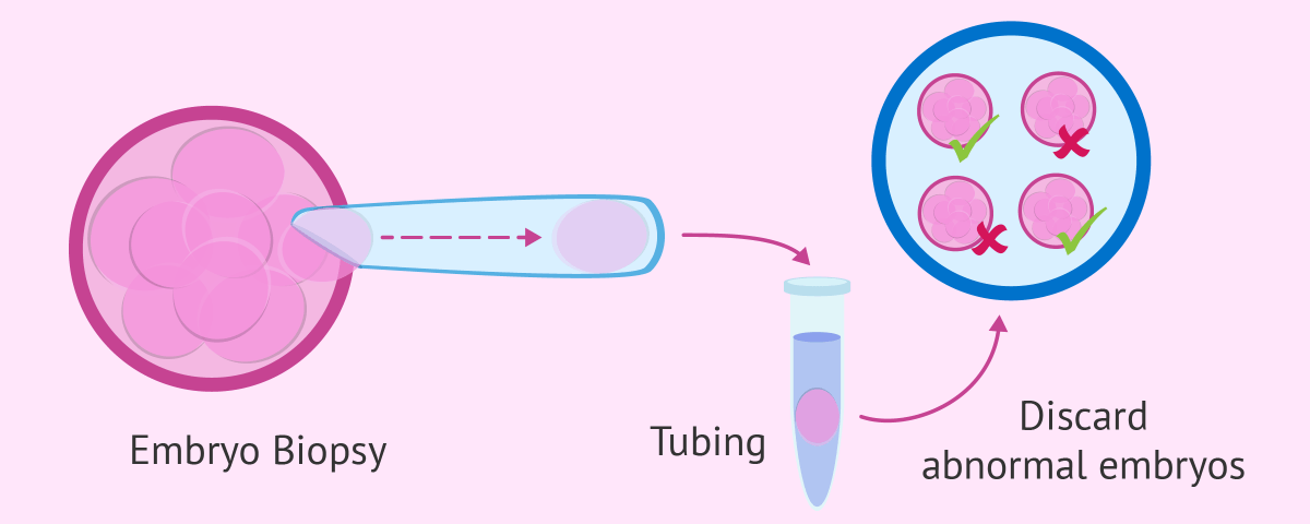 Preimplantation Genetic Testing Preimplantation Genetic Testing
