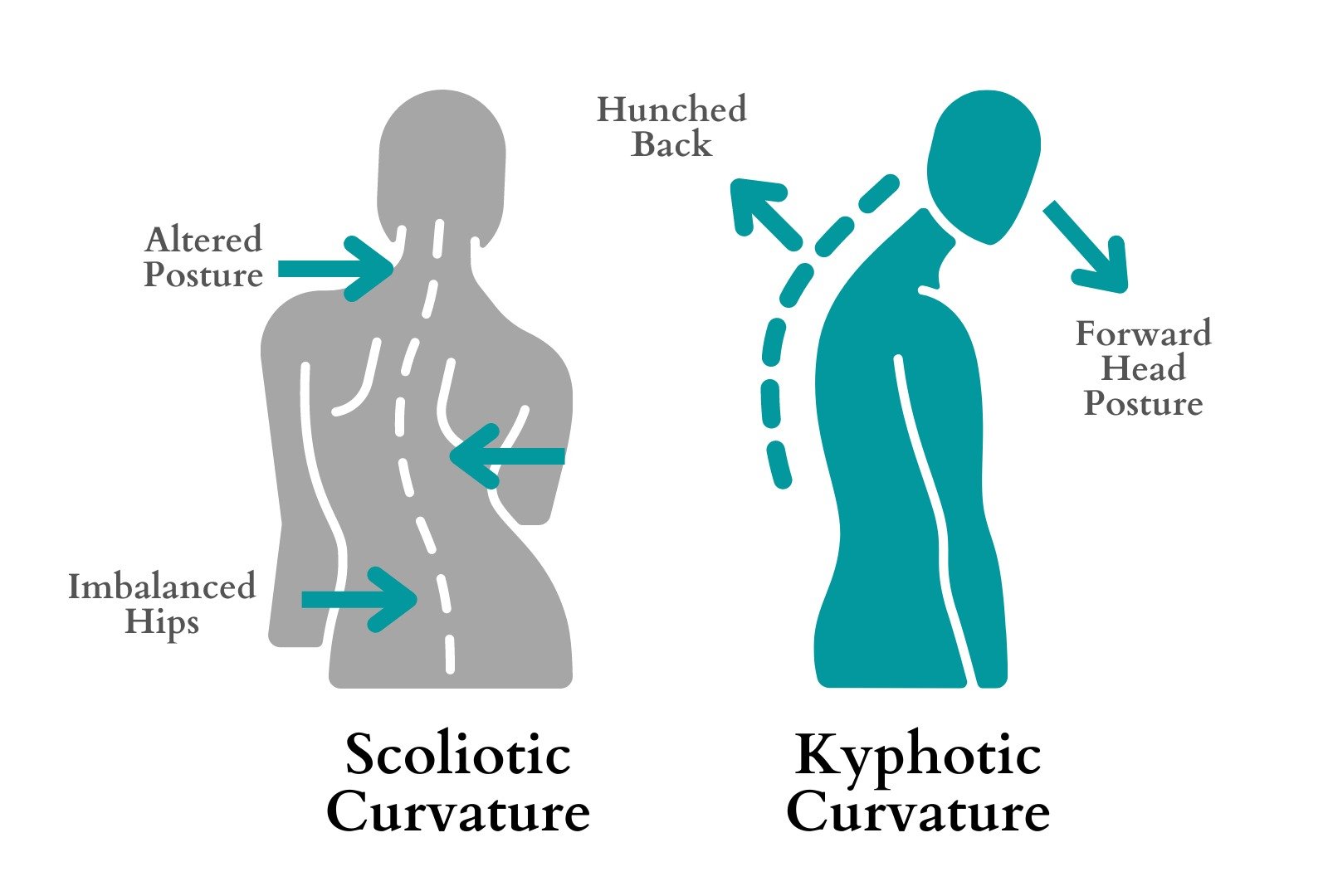Scoliosis and Kyphosis Spine Surgery Scoliosis and Kyphosis Spine Surgery