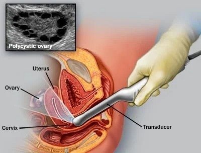 Sonography
